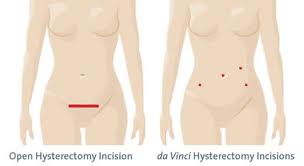Pap Smear Singapore